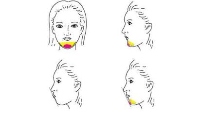 成都醫(yī)美醫(yī)院排名榜top5，是否包括權(quán)威專(zhuān)家的評(píng)選？