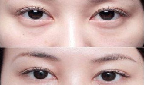 成都眼部整形醫(yī)生高分榜單發(fā)布！這些醫(yī)生哪家強(qiáng)？附詳細(xì)醫(yī)生信息