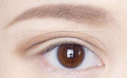 華中科技大學(xué)同濟醫(yī)學(xué)院附屬同濟醫(yī)院整形美容科：醫(yī)生技術(shù)究竟有何獨特之處？會帶來哪些效果？