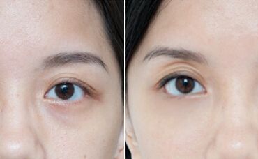 烏魯木齊子桐整形門診：了解李詠紅醫(yī)生的假體豐胸術(shù)的獨(dú)特風(fēng)格