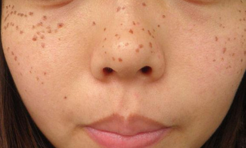 南京伊爾美醫(yī)療美容醫(yī)院真的可信嗎？有人分享他們的新醫(yī)院信息嗎？