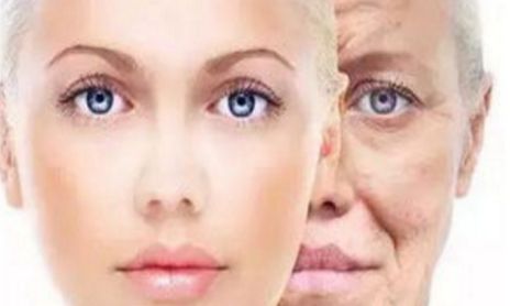 杭州藝星李斌斌如何實(shí)現(xiàn)自然雙眼皮2023年最新案例分享