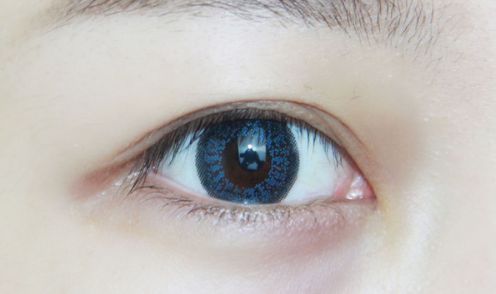 哈爾濱超龍整形醫(yī)院：雙眼皮術(shù)如何？專家給出全新醫(yī)學(xué)解決方案