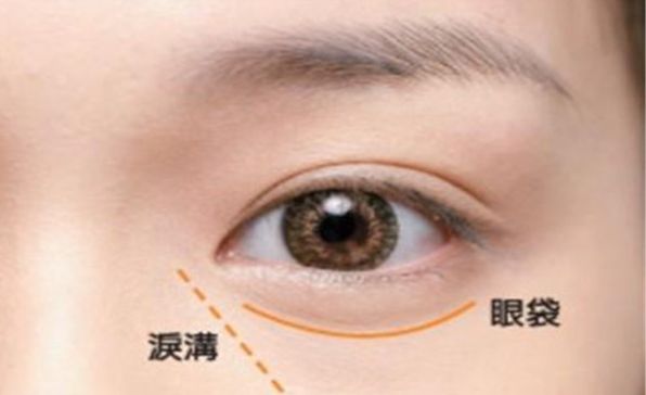 常州市有哪些專業(yè)的雙眼皮整形醫(yī)院值得推薦