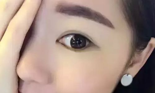 丁世凱教授：看看他的鼻子，醫(yī)生簡介+案例恢復(fù)過程圖參考