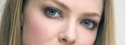 王醫(yī)生揭秘！湘雅附二實操雙眼皮術(shù)后成效公開！