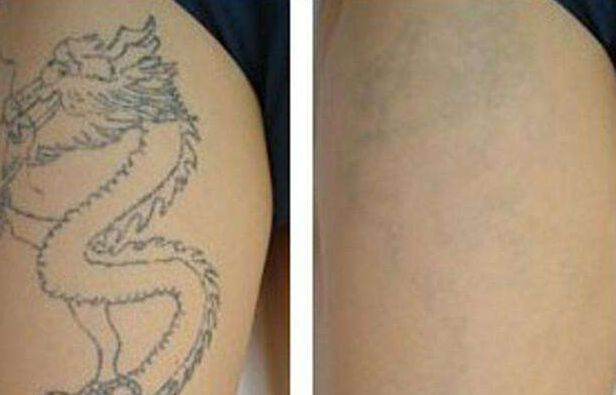 北京割雙眼皮哪家醫(yī)院口碑比較好？排名前三的醫(yī)院推薦！