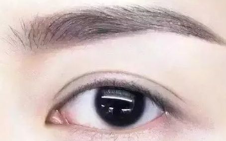 全國哪位專家值得信賴修復(fù)雙眼皮手術(shù)？頂級醫(yī)生排行榜首推名單揭曉