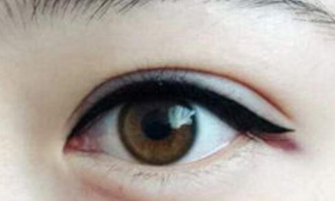 南京隆鼻術(shù)中高手脫穎而出！三位醫(yī)生實力強勁！