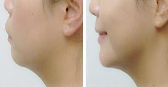 湘潭市哪家醫(yī)院擅長(zhǎng)激光祛斑？丨激光美容科普分享