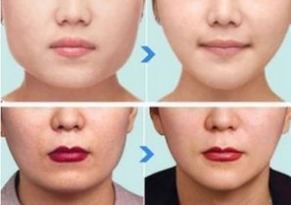 北京有哪些值得推薦的鼻整形醫(yī)生？年度五大鼻整形專家揭秘