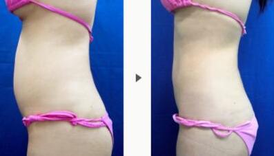 上海華美醫(yī)療美容整形醫(yī)院技術(shù)真的靠譜嗎？那里的醫(yī)生有經(jīng)驗(yàn)嗎？