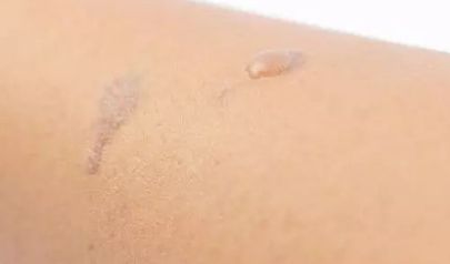 整形醫(yī)生楊小順在鄭州陽光創(chuàng)美進(jìn)行眼部手術(shù)口碑如何？