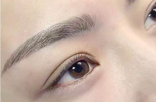 眼袋手術(shù)費(fèi)用及醫(yī)生評(píng)價(jià)與項(xiàng)目分析？