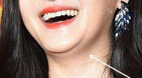 恩施州中心醫(yī)院整形外科療效如何？專家解析+服務(wù)費(fèi)用披露