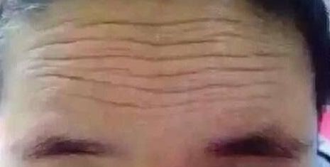 杭城明星級隱形隆胸醫(yī)院集結(jié)！來自美萊、格萊美等搶手好醫(yī)生！