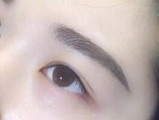 李炳澮醫(yī)生獨特的技術(shù) 手術(shù)風(fēng)格有何特點？并附帶隆鼻案例分析