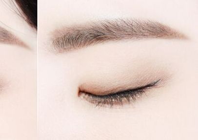 廣州哪家醫(yī)院的雙眼皮手術(shù)好？權(quán)威榜單熱門揭曉！