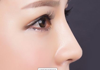 李天石磨骨費(fèi)用公示與患者見證，現(xiàn)網(wǎng)友分享醫(yī)師簡介！