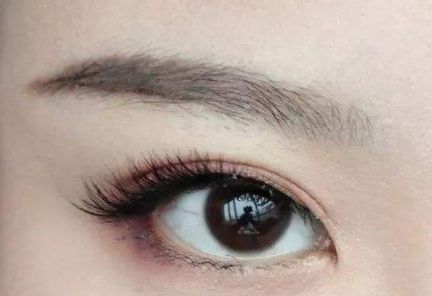 大連王琳雙眼皮的完美實(shí)踐，80天親身體驗(yàn)揭秘