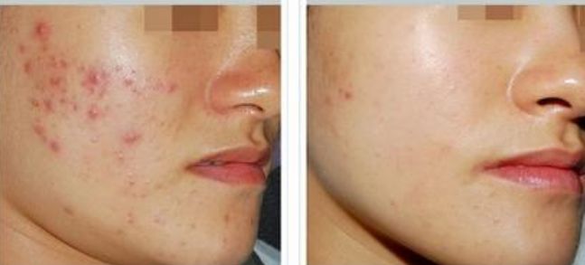 精準(zhǔn)又放心！臉部開眼角手術(shù)推薦哪座醫(yī)院好？