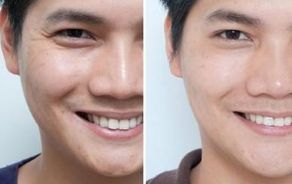 選擇正規(guī)的西安整形醫(yī)院，這些排行名單都推薦！