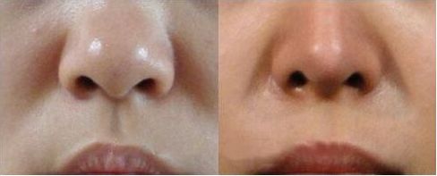 上海哪家醫(yī)院進(jìn)行拉皮手術(shù)的技術(shù)和聲譽(yù)最出色？