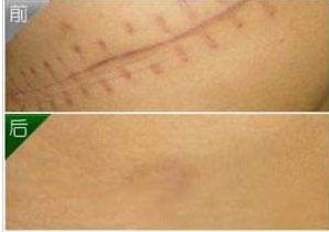 杭州面部脂肪填充推薦，首選頂級(jí)醫(yī)生信息大揭密