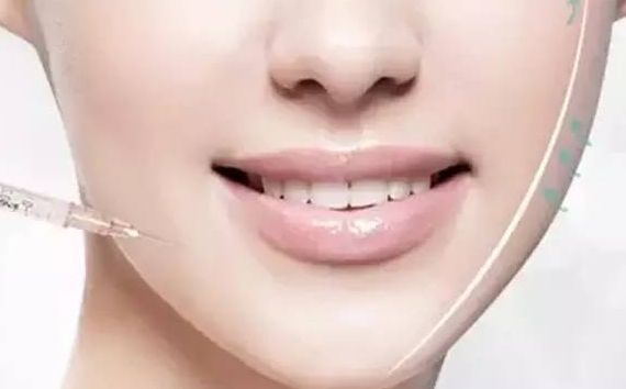 上海九院王健的雙眼皮手術(shù)效果如何？醫(yī)生經(jīng)驗(yàn)與成功案例分享