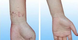 昆明最適合割雙眼皮的醫(yī)院是哪家？重點(diǎn)推薦的幾家醫(yī)院有哪些？