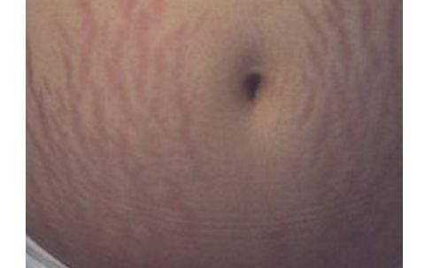 南昌佳美整形醫(yī)院：醫(yī)生團(tuán)隊強(qiáng)大，雙眼皮案例獨(dú)具匠心