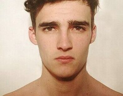 湘雅醫(yī)院龍劍虹的口碑如何？醫(yī)術(shù)出眾，附真實雙眼皮術(shù)后恢復(fù)圖！