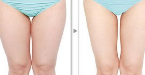 成都吳江山隆胸專家分享醫(yī)生實力和患者經歷