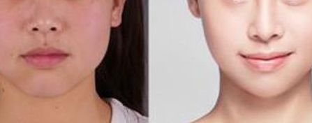 北京最具實力的植發(fā)醫(yī)院推薦，讓您了解八大處整形醫(yī)院植發(fā)費用與醫(yī)生水平