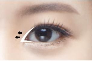 禪城區(qū)中心醫(yī)院整形科成功改變徐威強下頜角，告別「方姐」稱號！