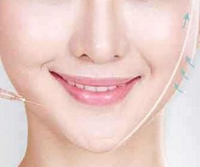 大坪醫(yī)院金絲骨針術(shù)醫(yī)師值得推薦，服務(wù)價(jià)格一覽無余！