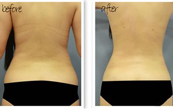 北京哪位醫(yī)生在八大處進(jìn)行隆胸手術(shù)較為專業(yè)？