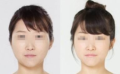 廣州哪家醫(yī)院能夠有效除皺？詳細介紹醫(yī)院基本情況分享