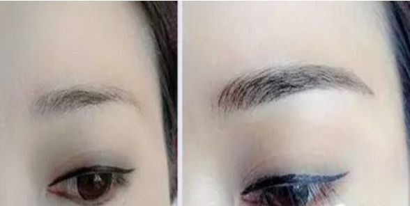 上海最受醫(yī)生推薦的醫(yī)美中心，瑞金整形項(xiàng)目?jī)r(jià)格公開(kāi)！