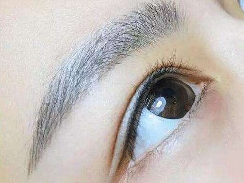 醫(yī)生技術(shù)驚艷！重醫(yī)賀光照眼部整形迎來新突破