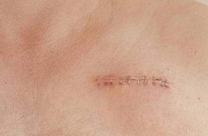 溫州附屬第一醫(yī)院鄭君達(dá)主治領(lǐng)域及醫(yī)療項(xiàng)目詳解