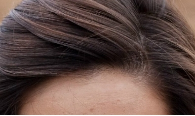 陽(yáng)泉煤業(yè)集團(tuán)總醫(yī)院整形美容科2023價(jià)格表：優(yōu)惠價(jià)格真實(shí)可信嗎？醫(yī)師團(tuán)隊(duì)經(jīng)驗(yàn)豐富？