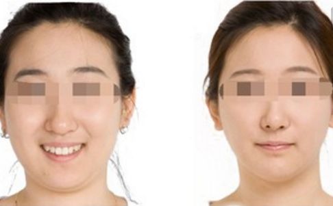 鄭州哪位醫(yī)生在鼻整形領(lǐng)域赫赫有名？口碑出類拔萃的五位專家揭曉！