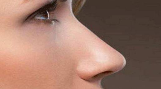 雙眼皮修復(fù)失敗后的最佳時機是什么時候？