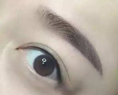 廈門哪家整形醫(yī)院口碑好？專家推薦薇格、中山前三！