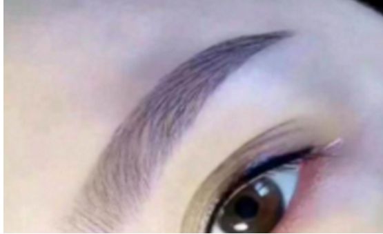 上海求美醫(yī)院最權(quán)威的拉皮整形專家名單及案例分享，查看收費(fèi)明細(xì)表