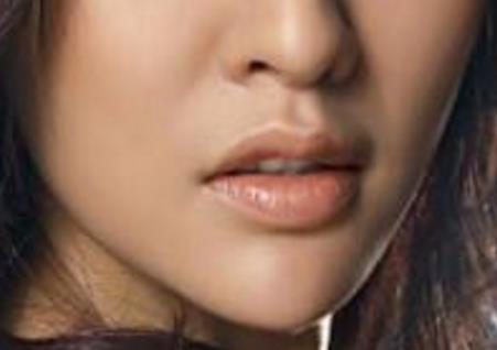 滄州中心醫(yī)院整形科馬超雙眼皮修復(fù)有哪些效果？是否可持久保持雙眼皮效果？