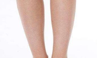 北京聯(lián)合麗格王巖醫(yī)生雙眼皮療效大揭秘，令人驚艷的成功案例浮出水面