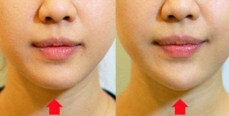 尋找北京地區(qū)值得推薦的優(yōu)質植發(fā)醫(yī)院