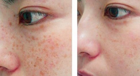 贛州亞韓醫(yī)療美容門診部整形手術(shù)適合嗎？吳禮誠醫(yī)生技術(shù)評價如何